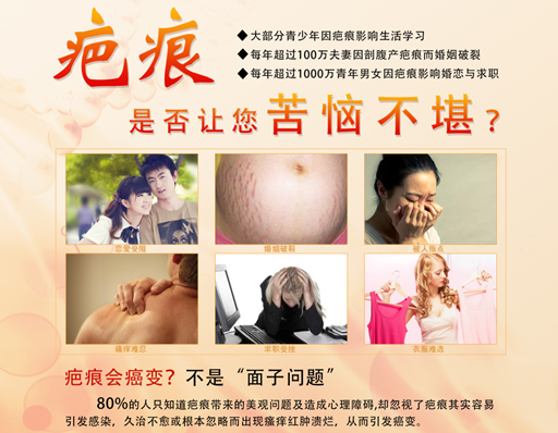 疤痕对人的影响