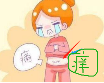 增生疤痕注意事项