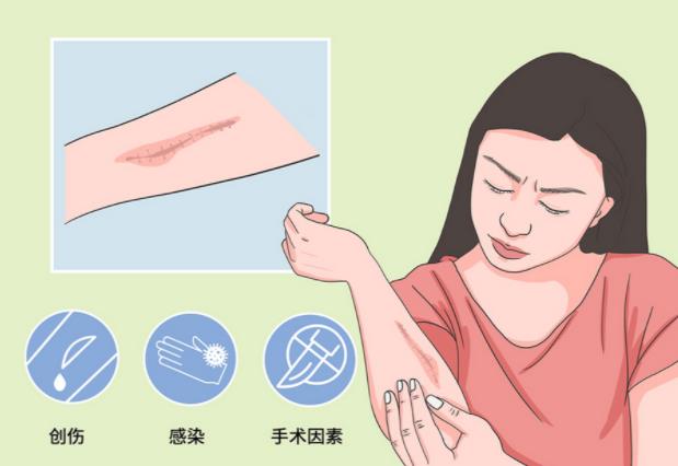 揭秘！疤痕形成的五大惊人原因，你中招了吗？